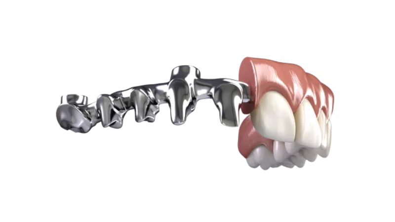 Neodent® NeoArch® 2